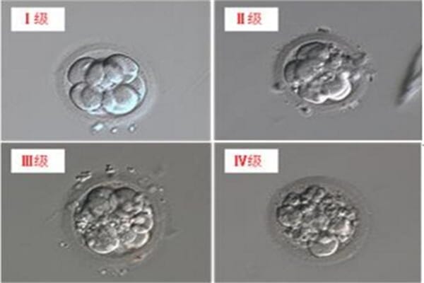 试管婴儿的囊胚级别有哪些？试管婴儿囊胚移植成功率高吗？试管婴儿囊胚移植多少钱一次？