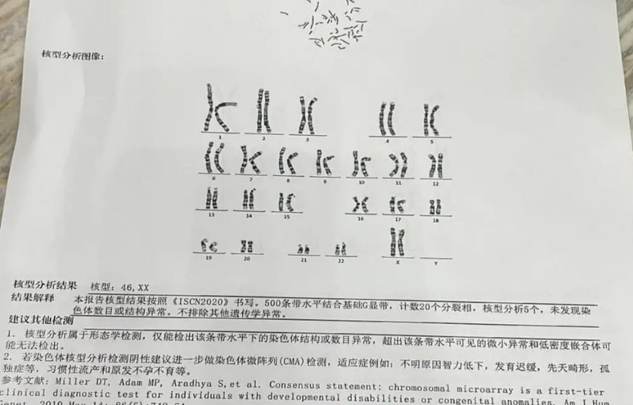 什么是染色体核型分析？为什么会出现染色体异常？试管婴儿孕前染色体检查费用？
