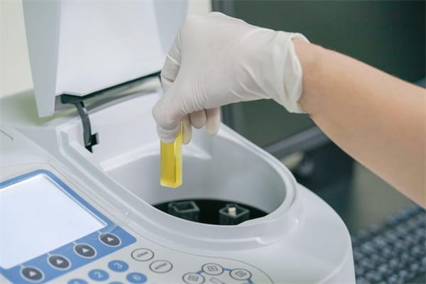 试管婴儿费用主要由几方面组成？各代试管婴儿技术的费用差别？