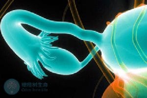 输卵管积水不孕，试管婴儿助您好孕——探索试管婴儿的费用之谜